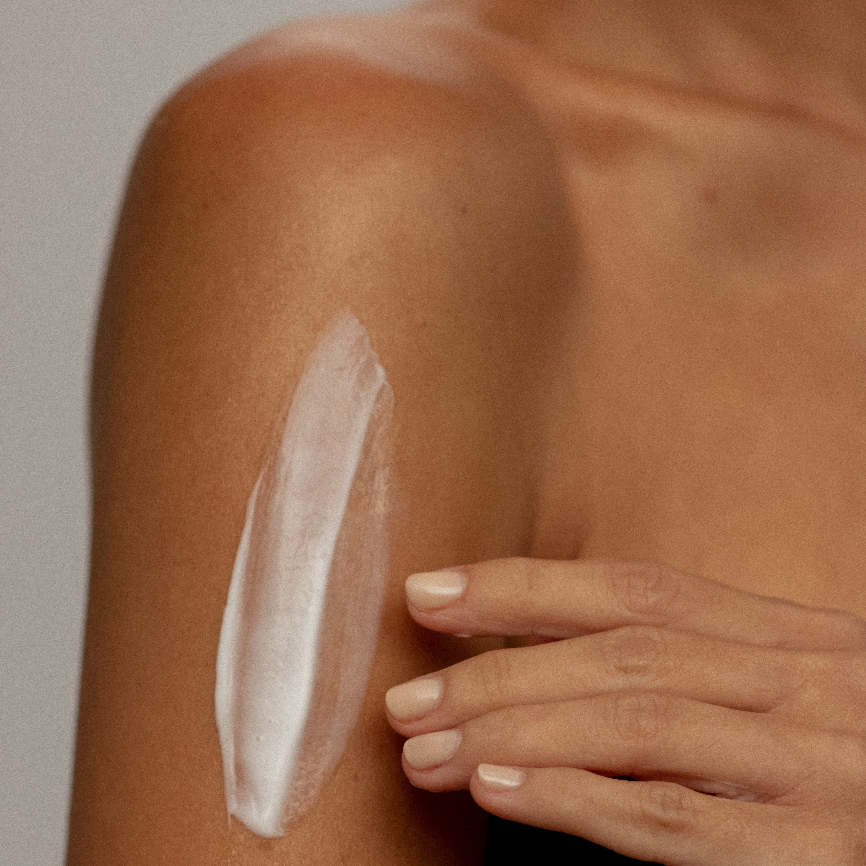 What’s Your Problem? Eczema