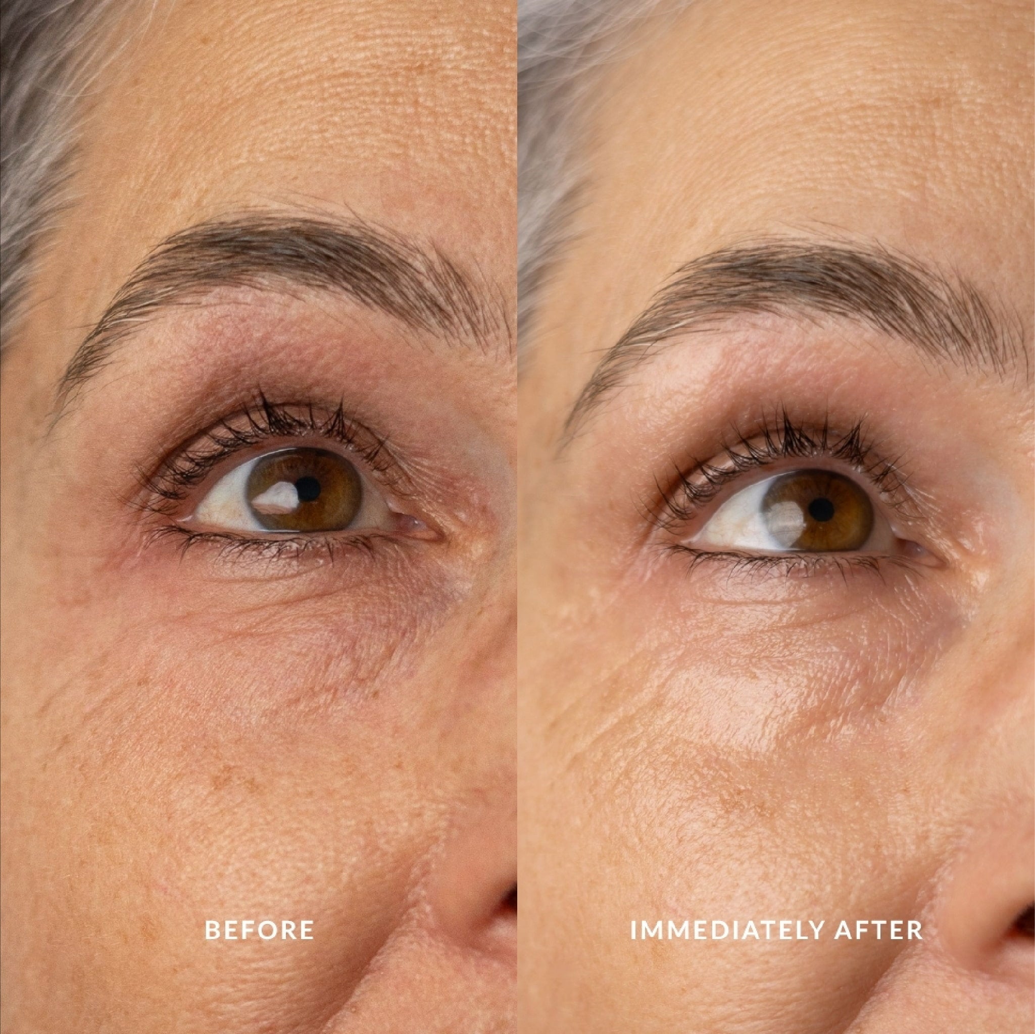 Before and immediately after photos showcasing the effects of Eco By Sonya Glory Eyes.
