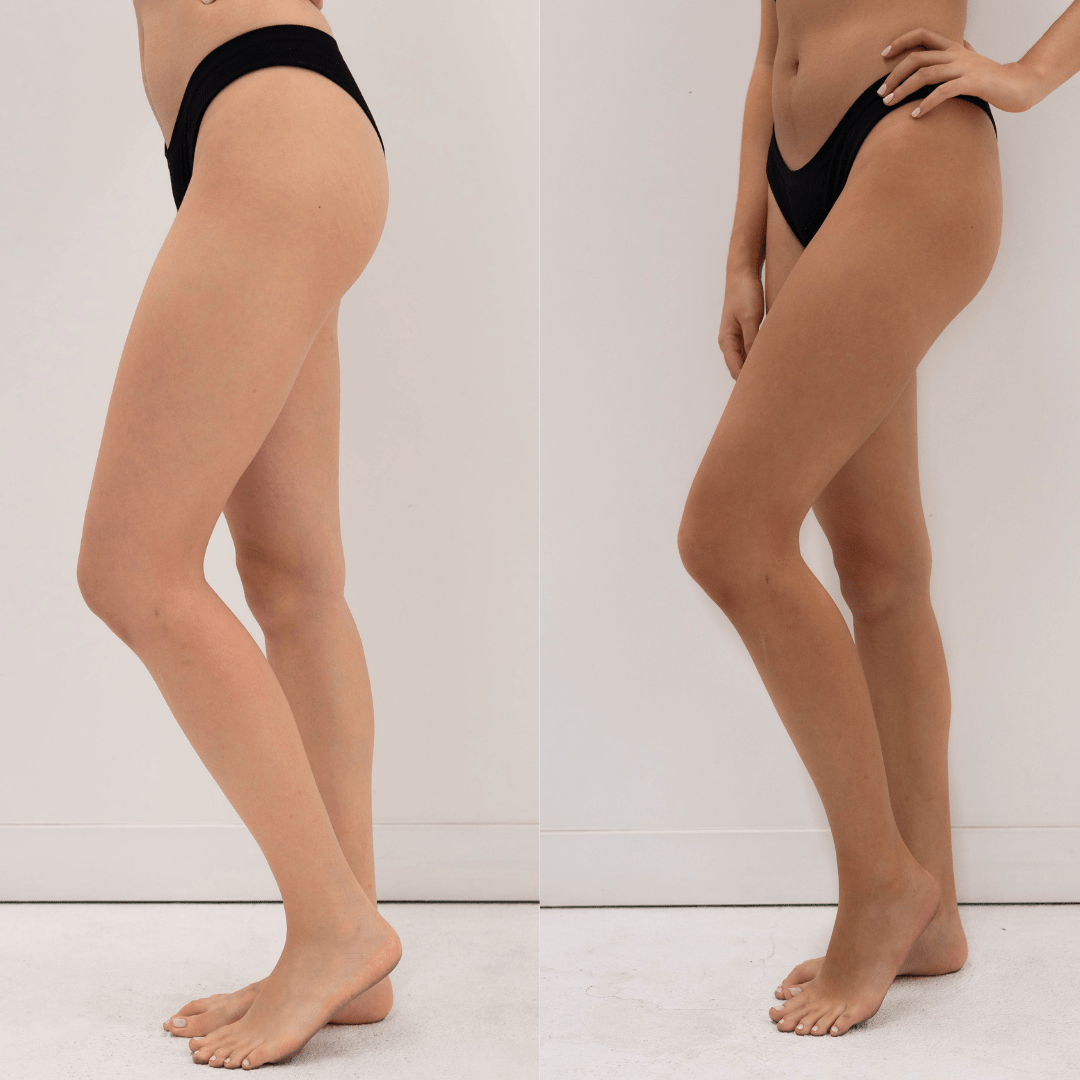 Eco by Sonya Winter Skin before after legs result gradual natural tan and moisturiser